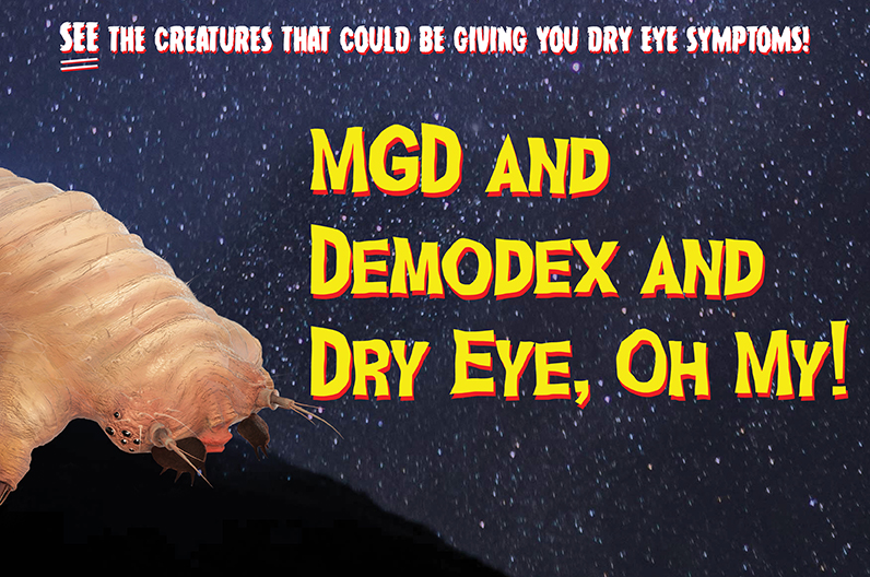 MGD And Demodex And Dry Eye, Oh My!