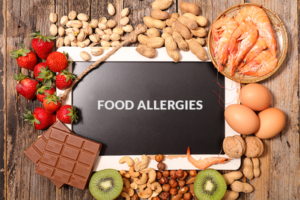 Can food allergies cause dry eyes?