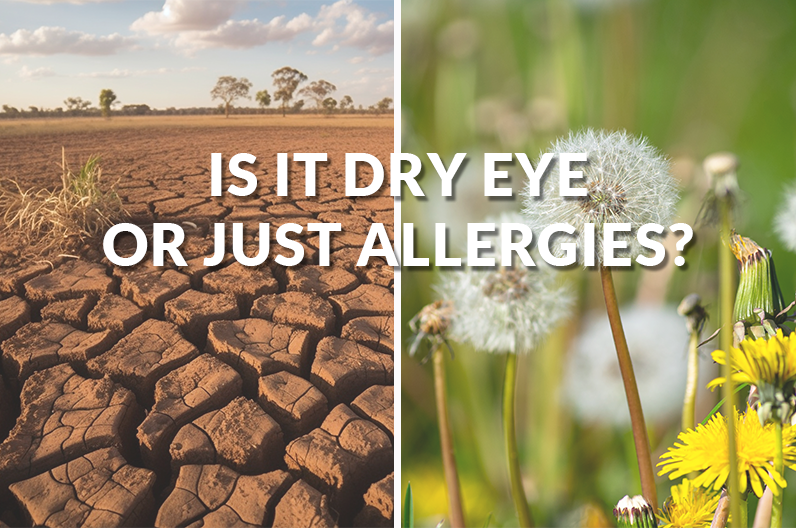 Is it dry eyes or just allergies?